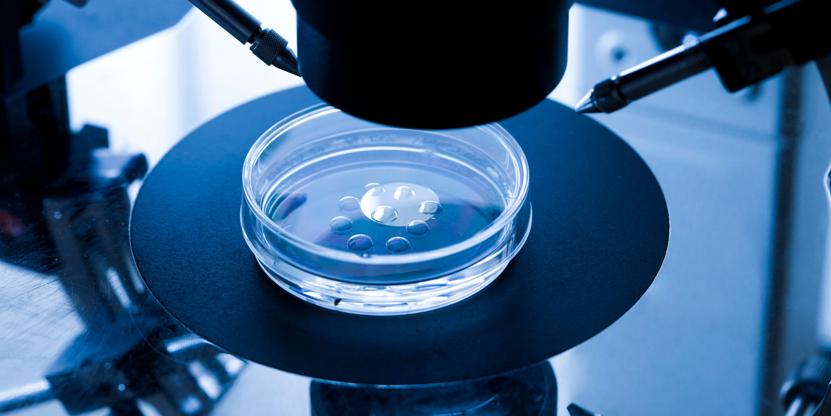 Acupuntura na fertilidade