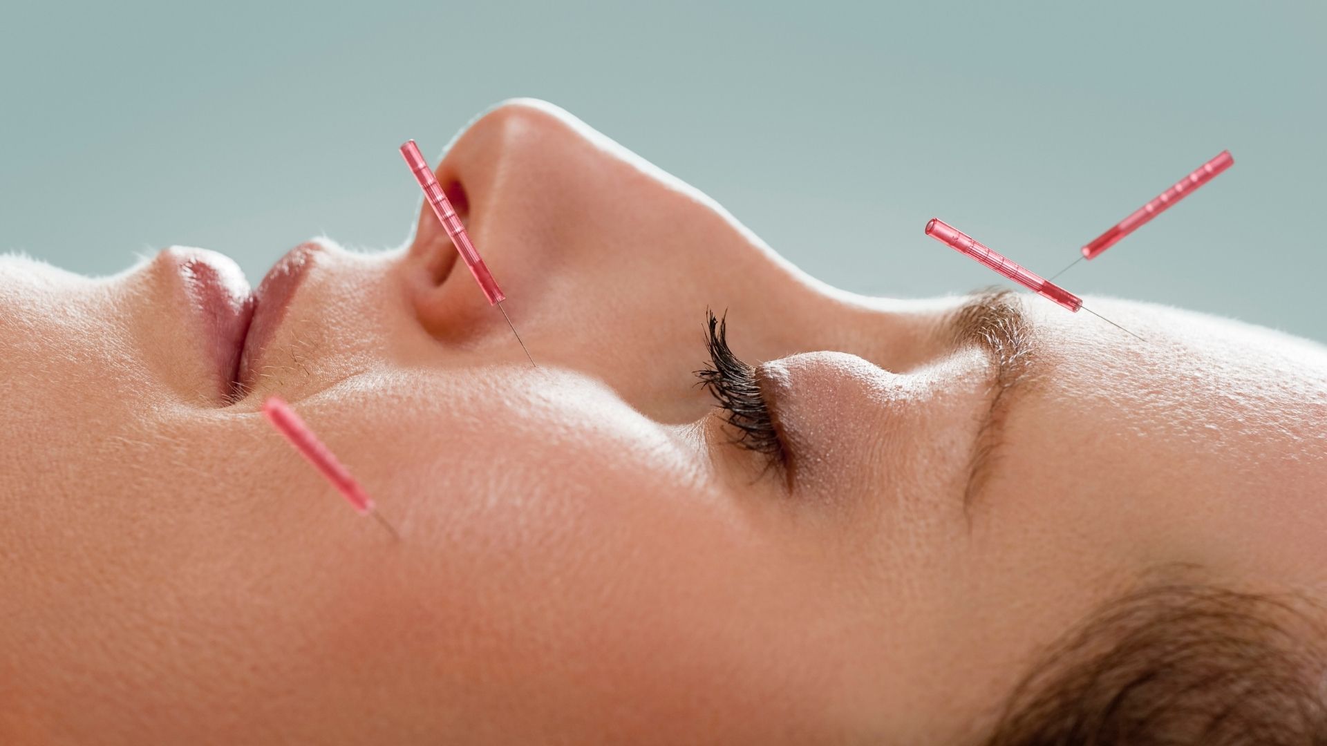 Acupuntura Facial